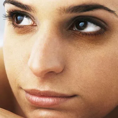 Read more about the article How to get rid of dark circles under eyes